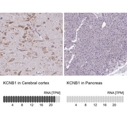 KCNB1 Antibody, Novus Biologicals 25 &mu;L, Unlabeled:Antibodies, Polyclonal